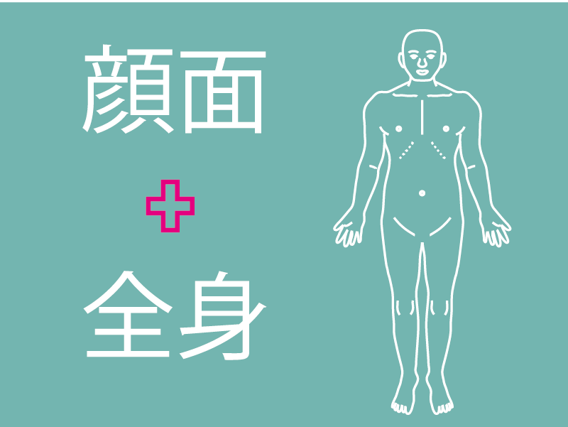 全身治療
