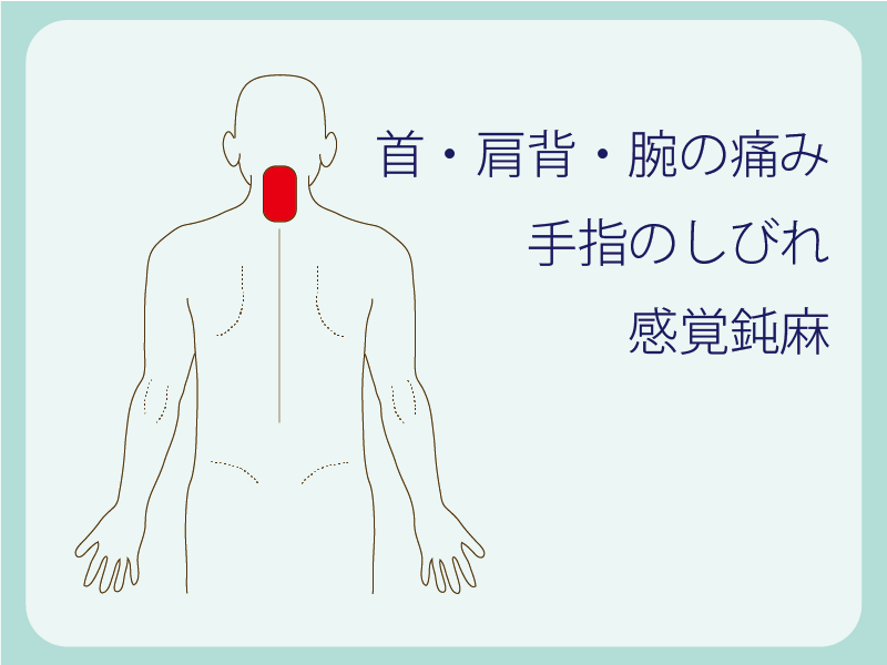 頚椎症によって出現する様々なつらい症状